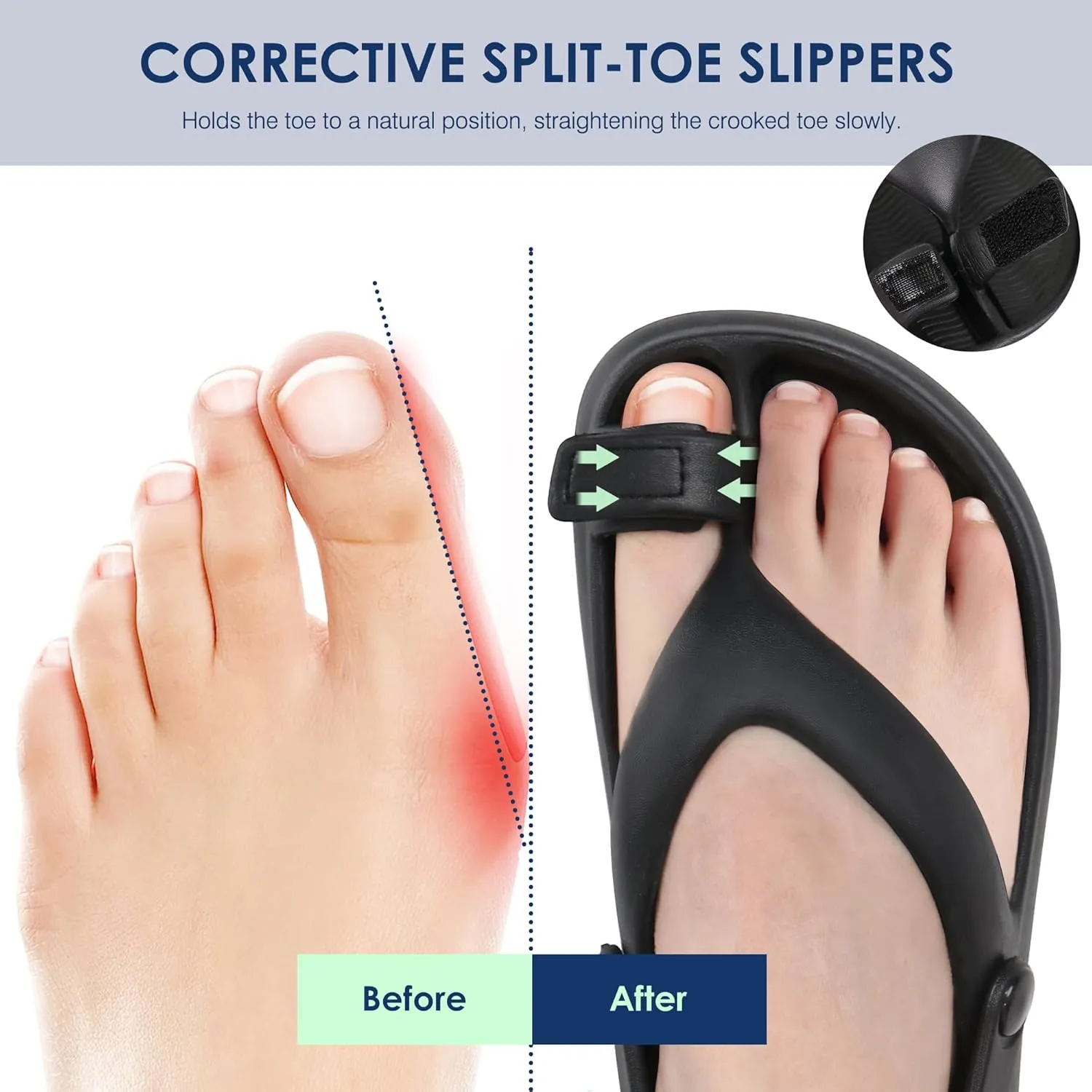 Ortho rest Women Orthopedic Bunion Sandals Orthotic Slides Walking Sandals